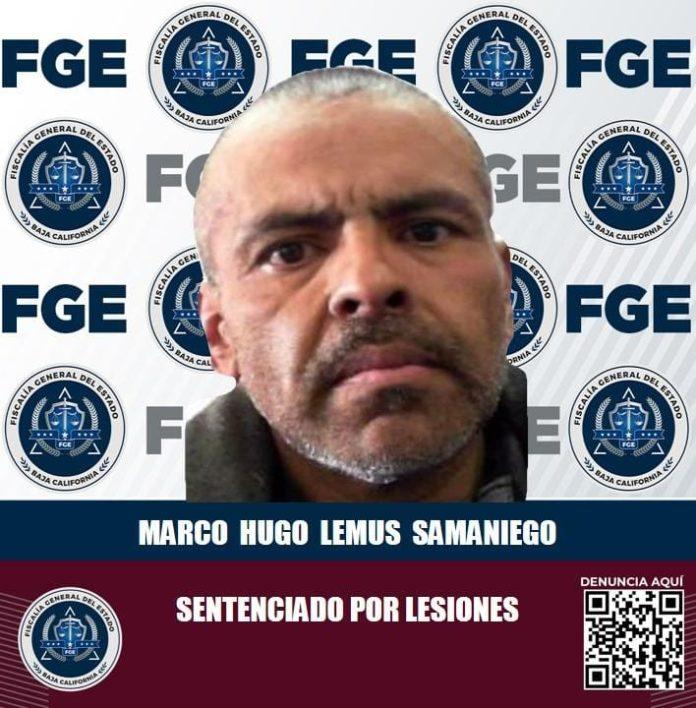 Logra Fiscalía fallo condenatorio por el delito de lesiones en Ensenada. lasnoticias.info
